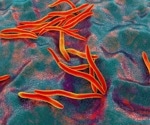 Scientists find a universal gut microbiome pattern linked to colorectal cancer