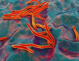 Scientists find a universal gut microbiome pattern linked to colorectal cancer