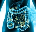 Gut microbes emerge as potential players in estrogen-driven cancers