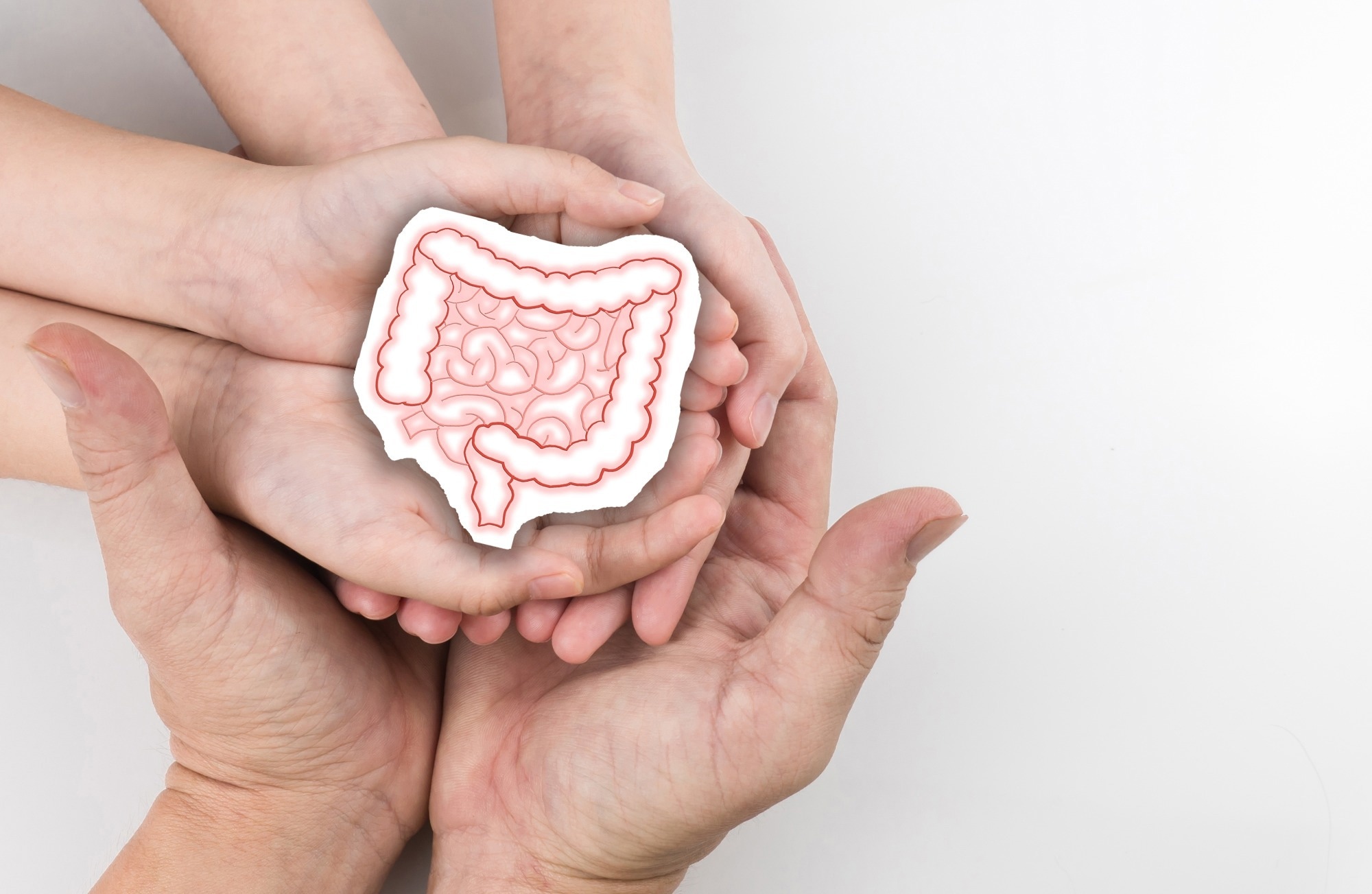 Could your birth characteristics influence colorectal cancer risk?