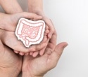 Could your birth characteristics influence colorectal cancer risk?