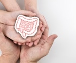 Could your birth characteristics influence colorectal cancer risk?