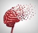 Blood metabolism maps how lifestyle tracks function in cognitive aging