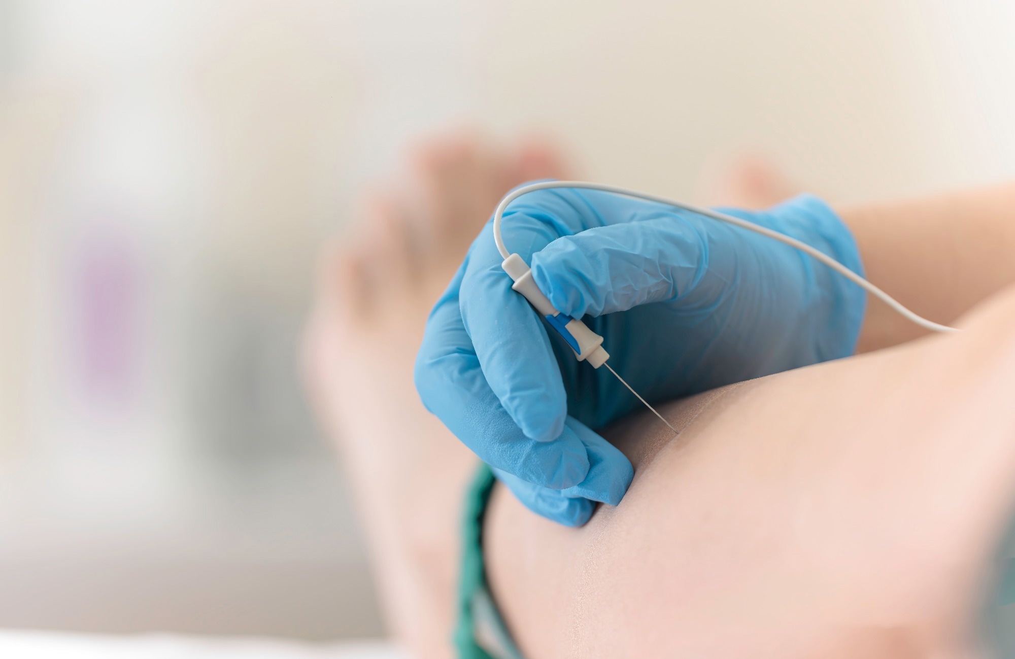 A healthcare professional prepares for an electromyography procedure, focusing on the patient