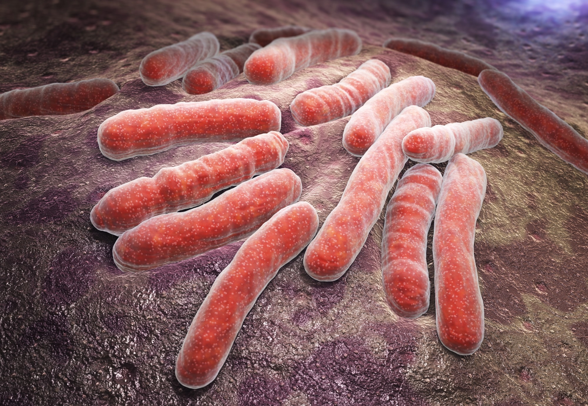 Study: Risk of incident tuberculosis after severe COVID-19: a nationwide cohort study. Image Credit: Tatiana Shepeleva / Shutterstock
