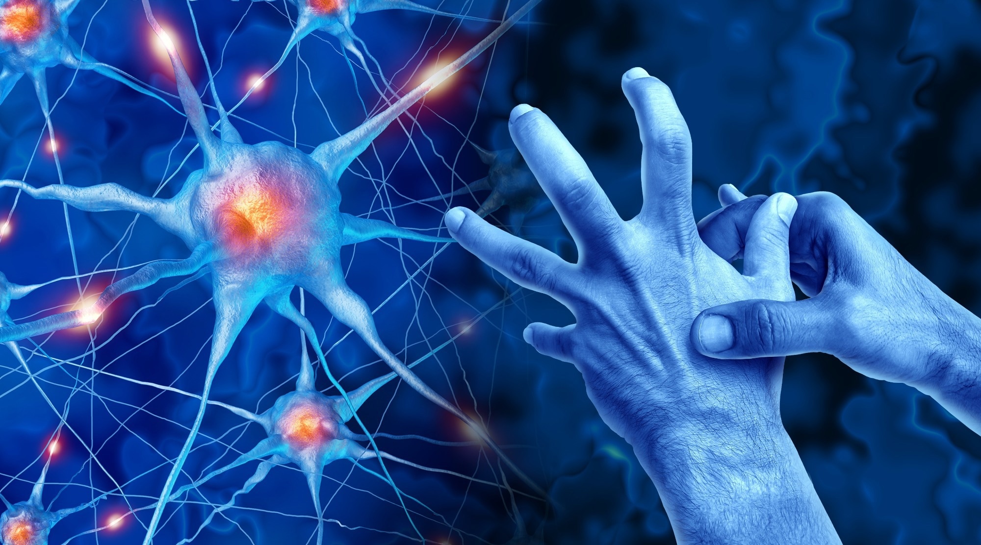 Study: Global regional and national burden and trends of early-onset Parkinson’s disease from 1990 to 2021. Image Credit: Lightspring / Shutterstock
