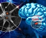 Short sleep and poor sleep quality track with Parkinson’s risk