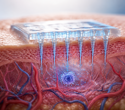 Cosmetic microneedles deliver actives where creams struggle