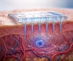 Cosmetic microneedles deliver actives where creams struggle