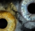 Smoking shows no major impact on the eye microbiome in small study