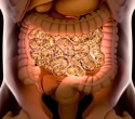 Nine gut bacteria linked to future type 2 diabetes risk