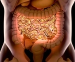 Nine gut bacteria linked to future type 2 diabetes risk