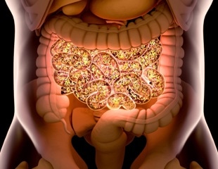 Nine gut bacteria linked to future type 2 diabetes risk
