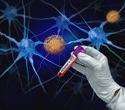 Blood p-tau217 levels signal cognitive impairment risk years before symptoms emerge