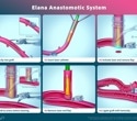 A breakthrough in coronary bypass surgery: AMT Medical’s SAFE-CAB results published in The Journal of Thoracic and Cardiovascular Surgery