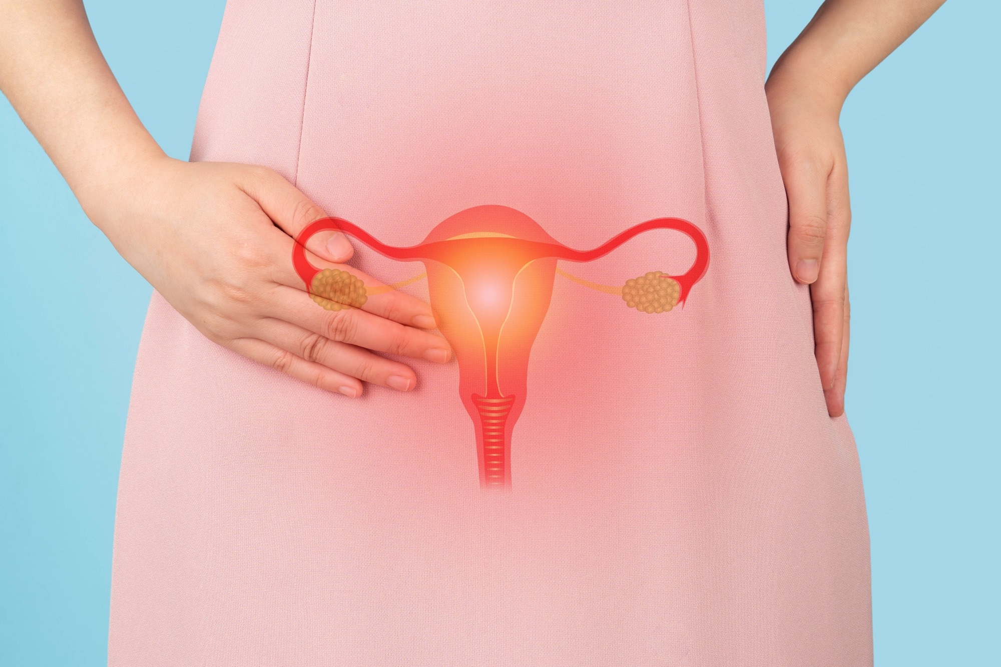 Study: Adjunctive vitamin D supplementation in women receiving dienogest therapy for endometriosis: a randomized controlled trial. Image Credit: Orawan Pattarawimonchai / Shutterstock