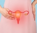 Vitamin D falls short as an add-on treatment for endometriosis