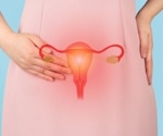 Vitamin D falls short as an add-on treatment for endometriosis