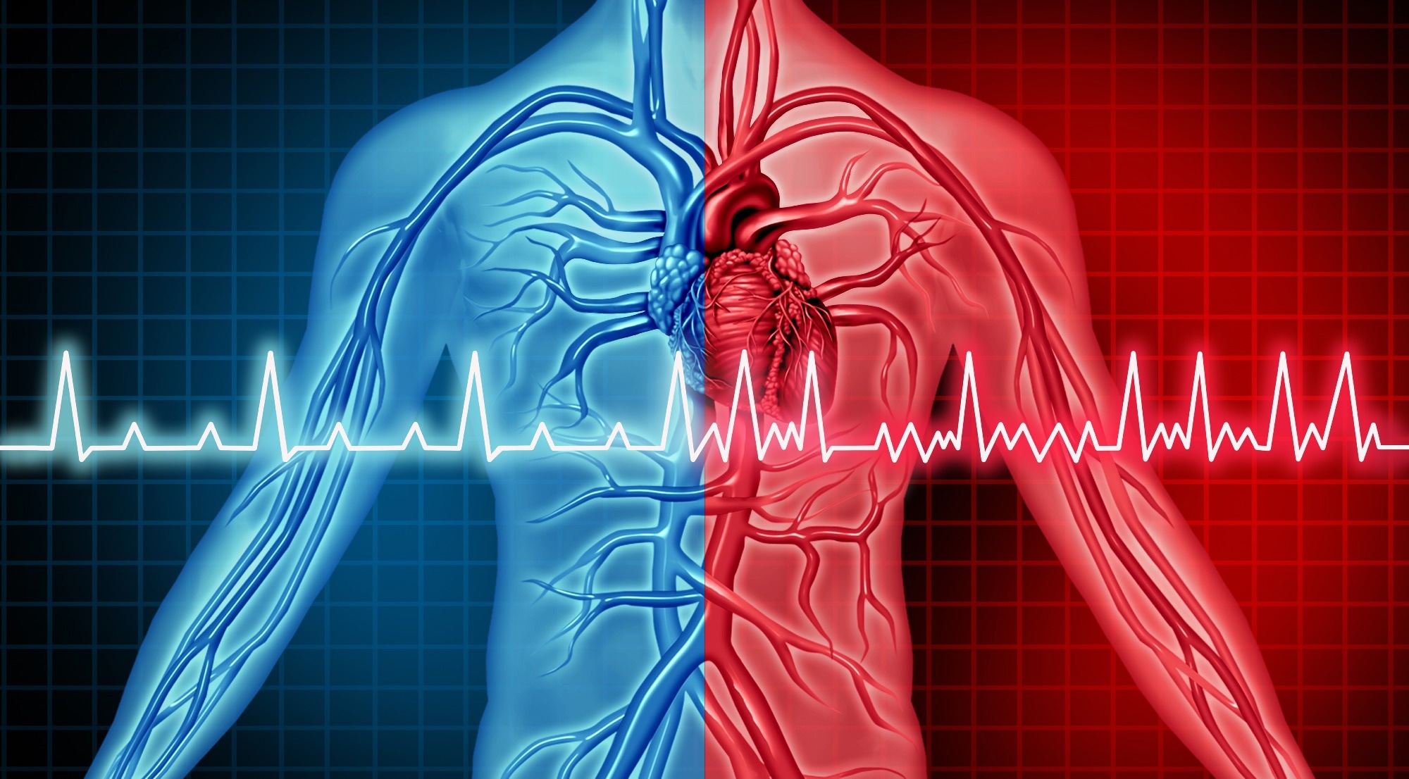 A common dietary nutrient feeds a gut pathway linked to atrial fibrillation