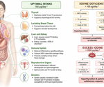 Too little or too much iodine may push immunity off balance