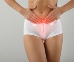 Lifestyle habits may explain difference in endometriosis symptoms