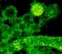 Severe COVID-19 reactivates dormant viruses and may leave a lasting viral signature
