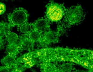 Severe COVID-19 reactivates dormant viruses and may leave a lasting viral signature