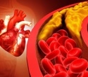 Genetic analysis of 1 million people points to FNIP1 as a promising metabolic target