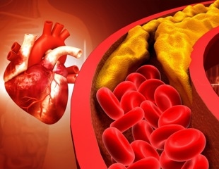 Genetic analysis of 1 million people points to FNIP1 as a promising metabolic target