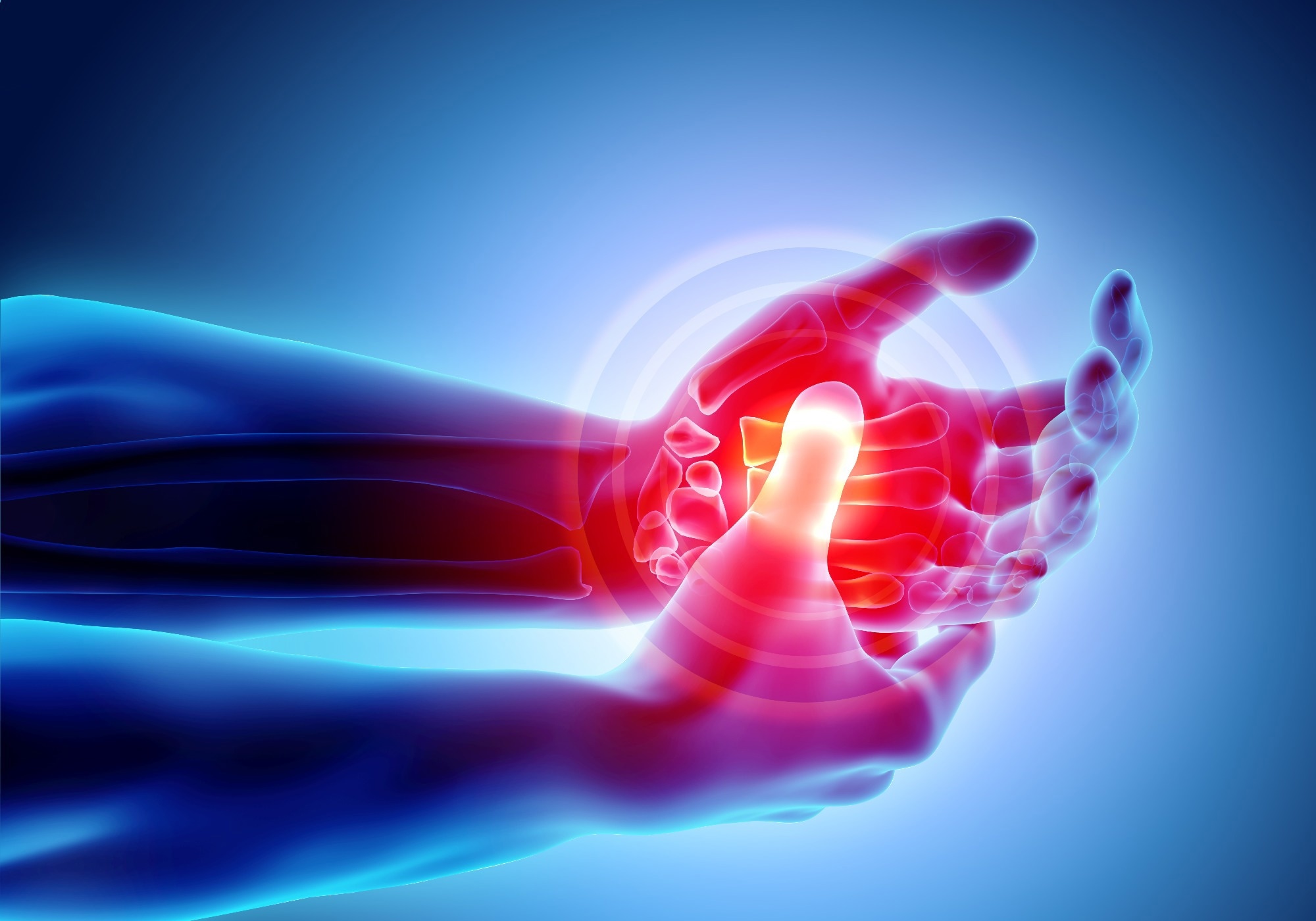 Study: Effects of air pollution on disease activity in patients with rheumatoid arthritis. Image Credit: MDGRPHCS / Shutterstock