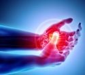 Fine particle pollution raises rheumatoid arthritis flare risk and disease activity