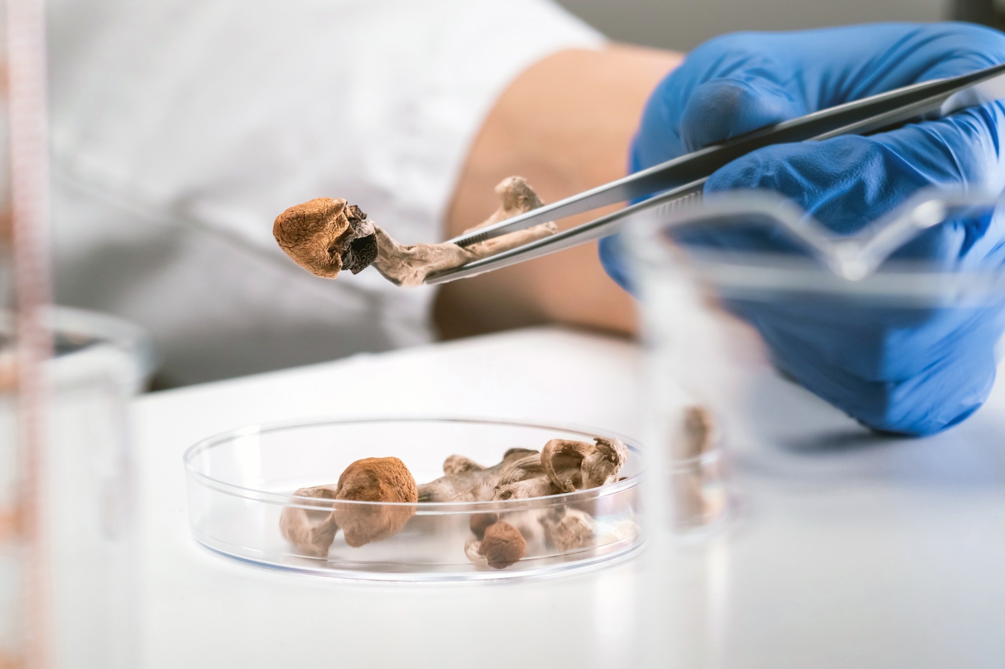 Study: Psilocybin-assisted therapy for treatment-resistant major depressive disorder in a public healthcare setting: a randomized controlled trial. Image Credit: 24K-Production / Shutterstock