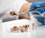 Single-dose psilocybin shows promise for treatment-resistant depression in NHS trial