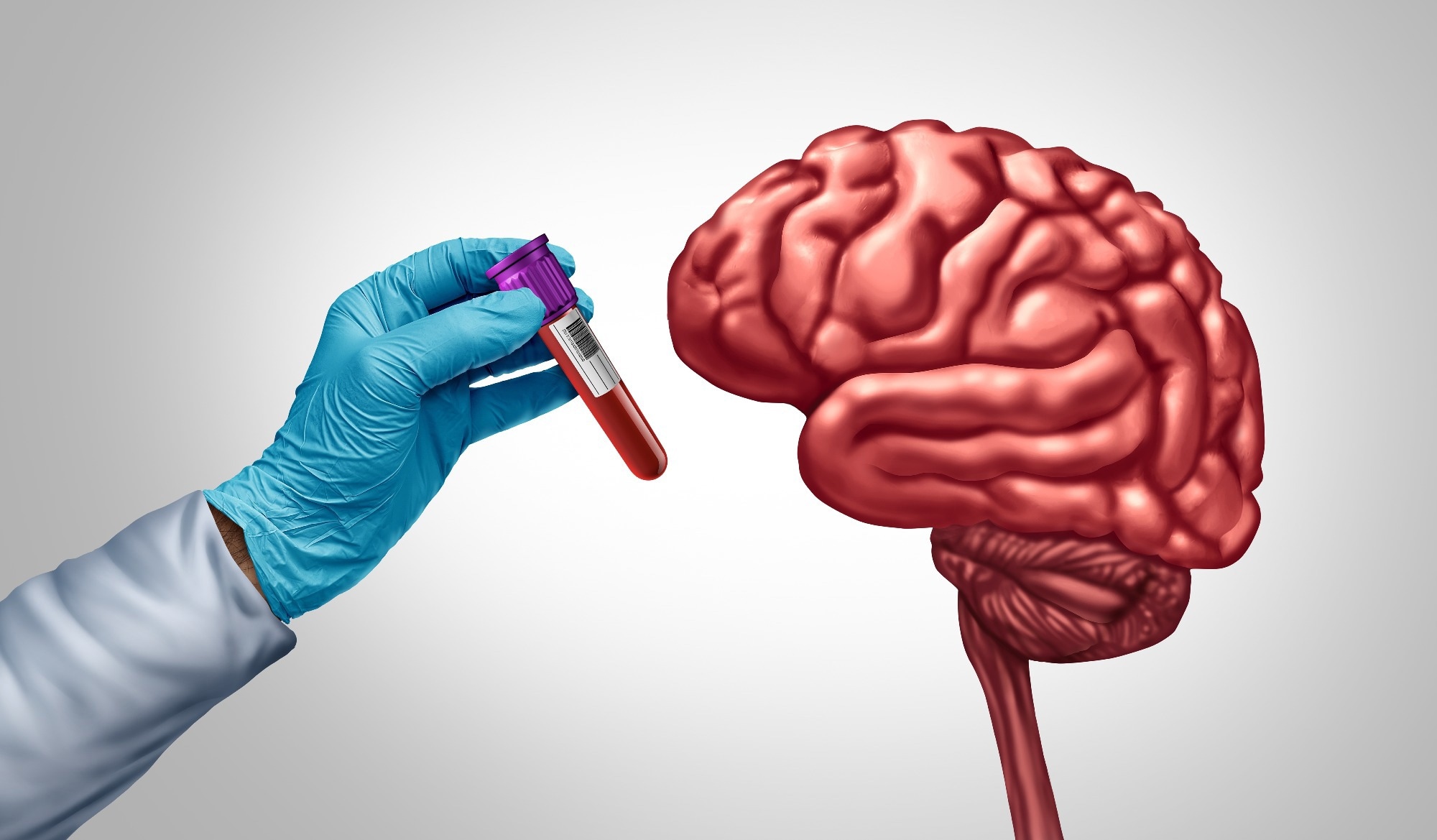 Study: Semaglutide attenuates a proteomics-based dementia risk signature in older adults with overweight or obesity and cardiovascular disease without diabetes: A post hoc analysis of the SELECT phase 3 trial. Image Credit: Lightspring / Shutterstock