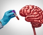 Semaglutide slows blood protein signature linked to future dementia risk