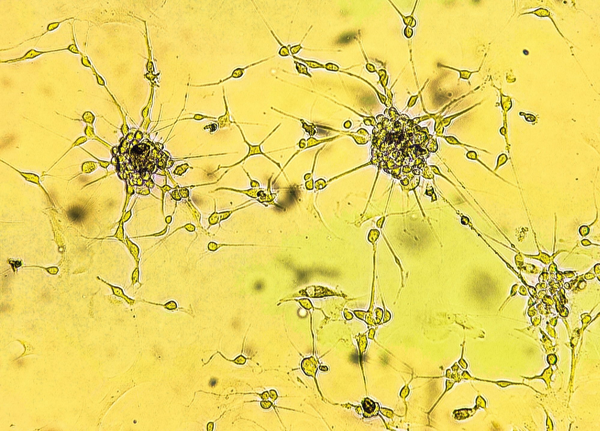 Spheroids of glioblastoma cell culture. Spheroidal structures of human malignant brain tumor cells under a microscope. Study: Cannabinoids suppress chemotherapy- and ionizing radiation-induced apoptosis of glioblastoma cells. Image Credit: Sergei Drozd / Shutterstock