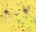 Cannabis compounds may weaken glioblastoma response to chemotherapy and radiation