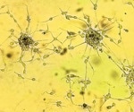 Cannabis compounds may weaken glioblastoma response to chemotherapy and radiation