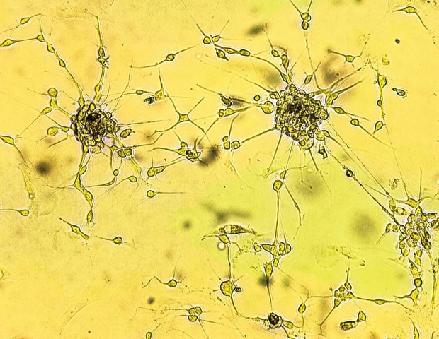 Cannabis compounds may weaken glioblastoma response to chemotherapy and radiation