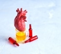 A 30-year study found a surprising link between alcohol, survival and heart attack risk