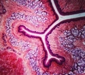 Deep-learning tissue clocks reveal how organs age and leave disease-linked signals in blood
