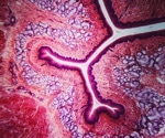 Deep-learning tissue clocks reveal how organs age and leave disease-linked signals in blood