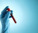 A single blood test could offer a glimpse of disease risk years in advance