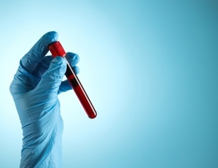 A single blood test could offer a glimpse of disease risk years in advance