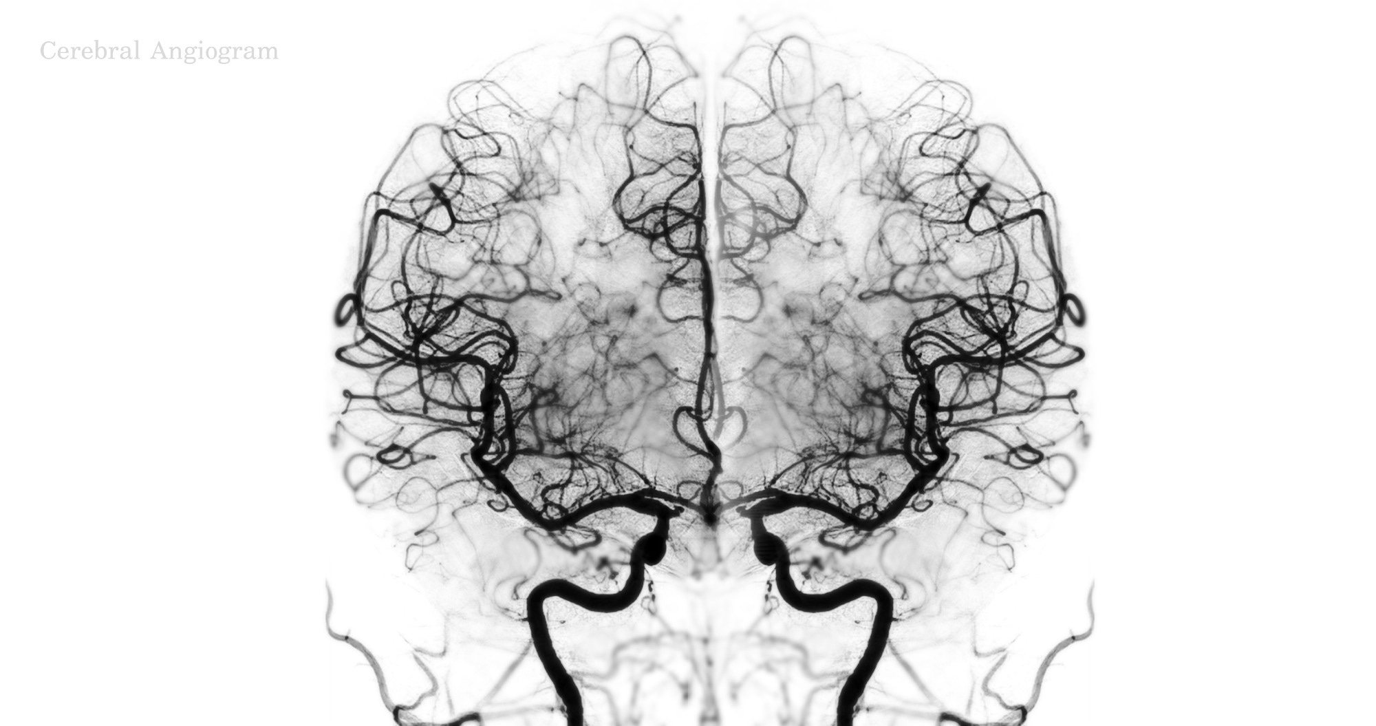 Study: Wake-activated neuronal populations that regulate sleep drive. Image Credit: Radiological imaging / Shutterstock