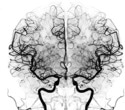 Wake-activated brain circuits reveal what drives the urge to sleep