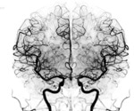 Wake-activated brain circuits reveal what drives the urge to sleep