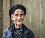 A striking immune cell pattern emerges around a person’s 100th birthday