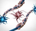 Faulty myelin-making brain cells may help drive cognitive decline with age
