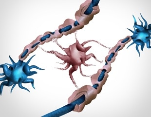 Faulty myelin-making brain cells may help drive cognitive decline with age
